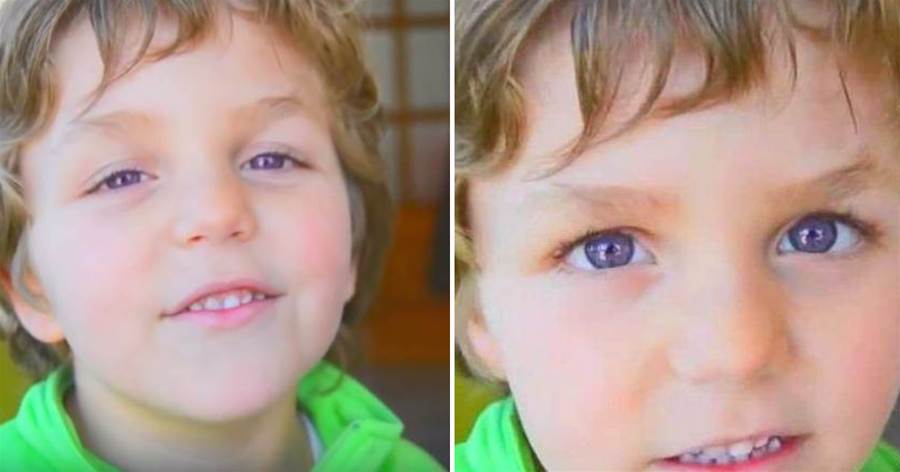 男孩長了雙「世界上最稀有」的眼睛，比戴上美瞳都好看，還有人曾為它投保幾百萬美元
