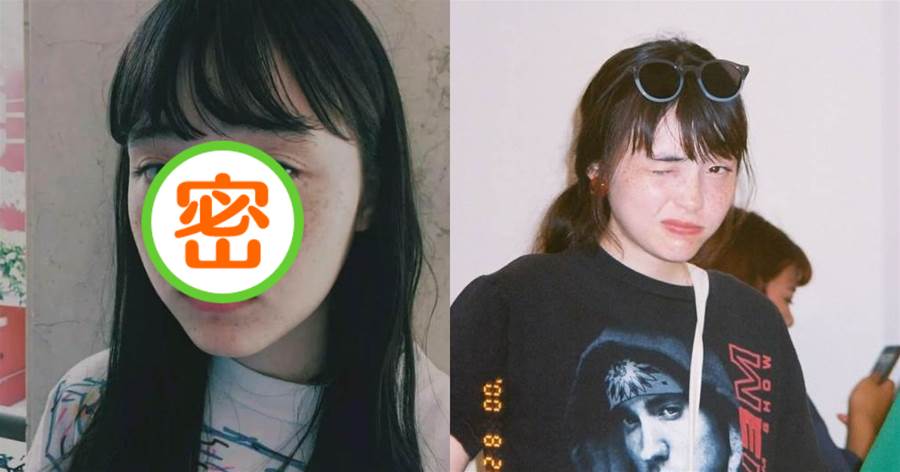 女孩長著一張「睡不醒的臉」，滿臉雀斑卻依舊火遍日本，網友：不完美也是一種美